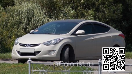 Hyundai | ELANTRA, AVANTE 5 (MD, UD) | P3W - MUSHROOM 0